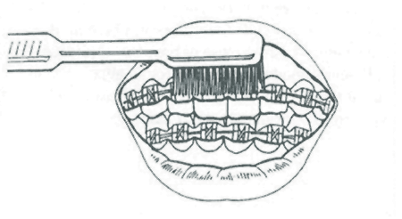 Brushing step 1