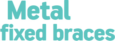 Metal fixed braces