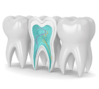 Root canal (Endodontics) at mydentist