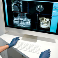 AI with dental technology